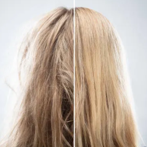 Frizzy Hair