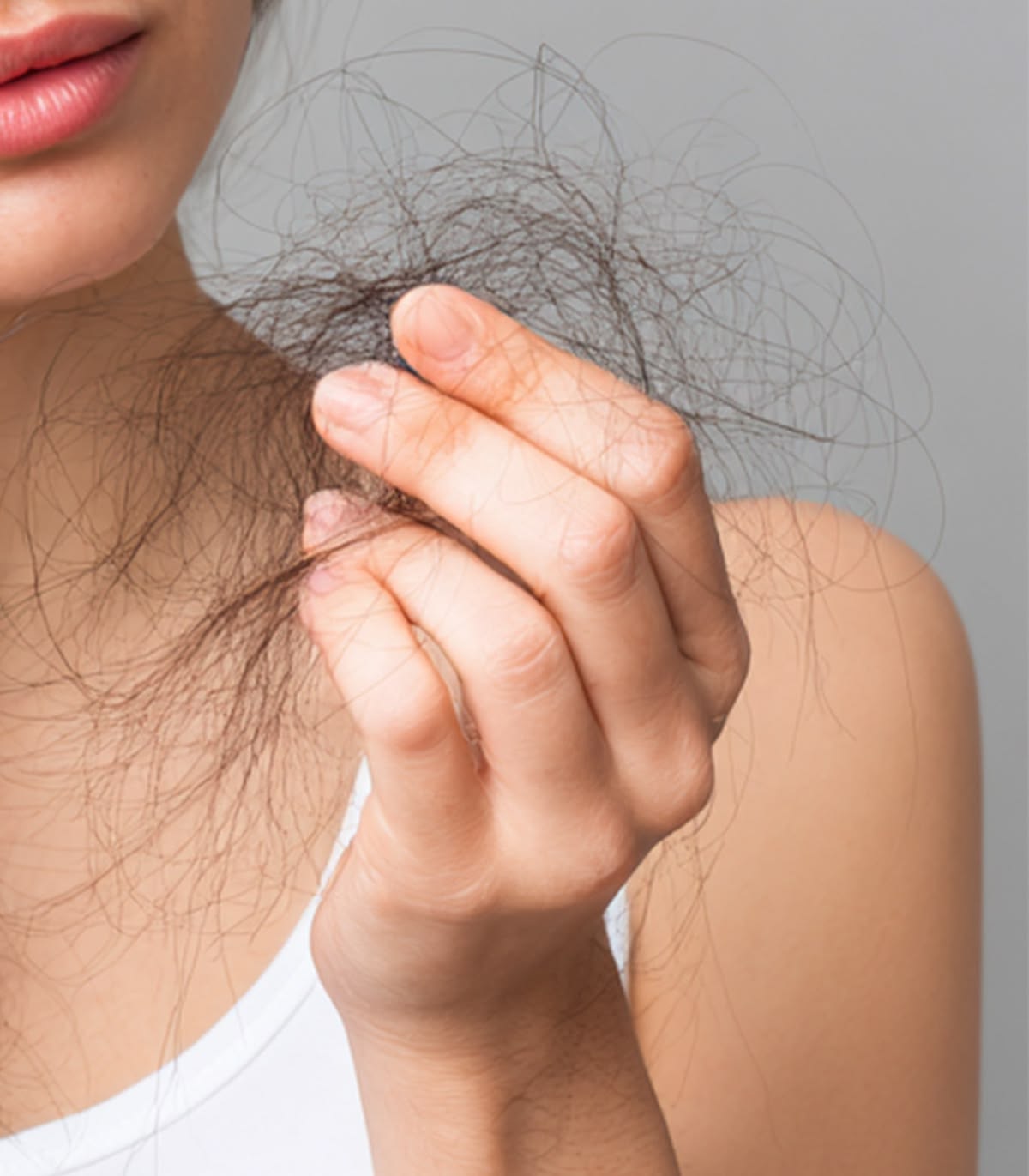 Hair Loss